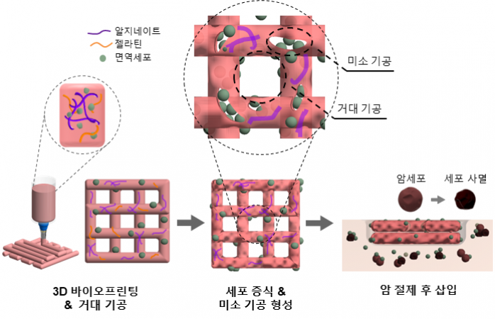 3D 바이오프린팅 기술로 암세포 제거한다