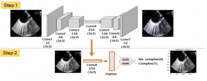 [KIMM Press Release] Medical Imaging Diagnostic Equipment Becomes Smarter Through Big Data and Deep Learning